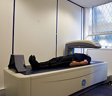 Dexa Scan