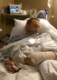 Travis post hand surgery